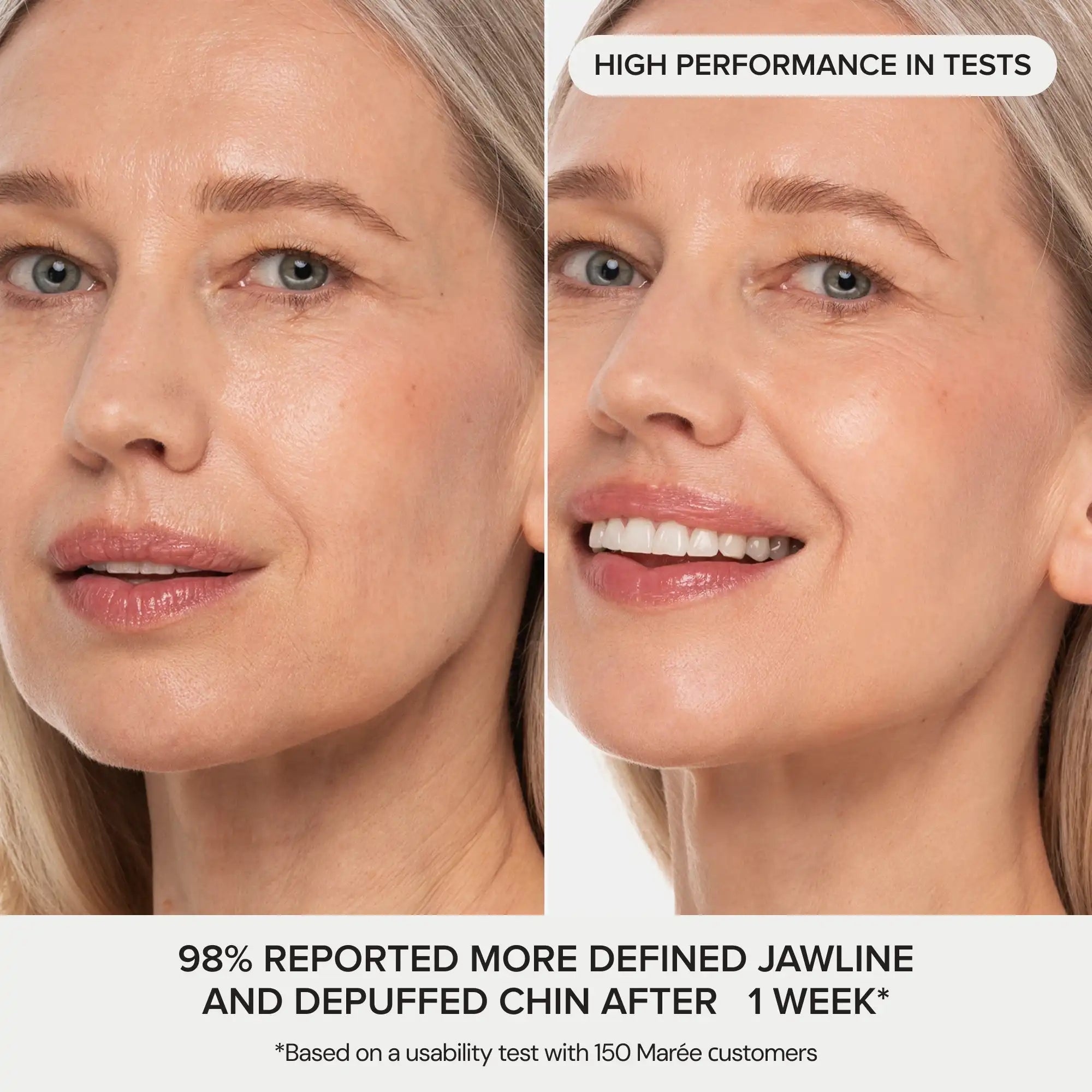 Jawline Reset™ 24K HydroLift Mask | V-Line Sculpting & Neck Treatment (20 Pack)